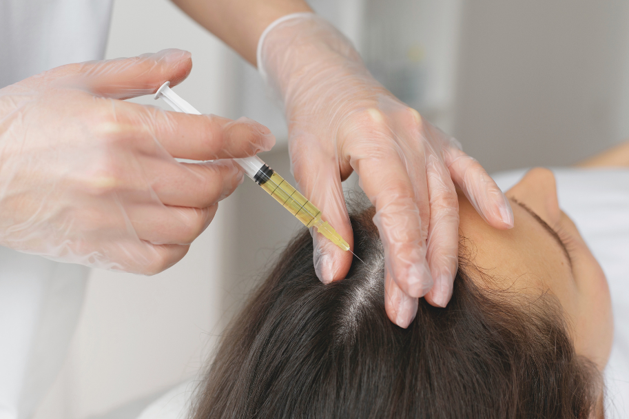 Terapia PRP: Soluția pentru creșterea naturală a părului