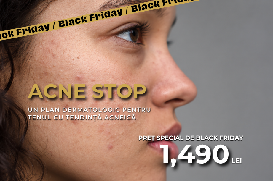 Acne Stop — un plan dermatologic pentru tenul cu tendință acneică