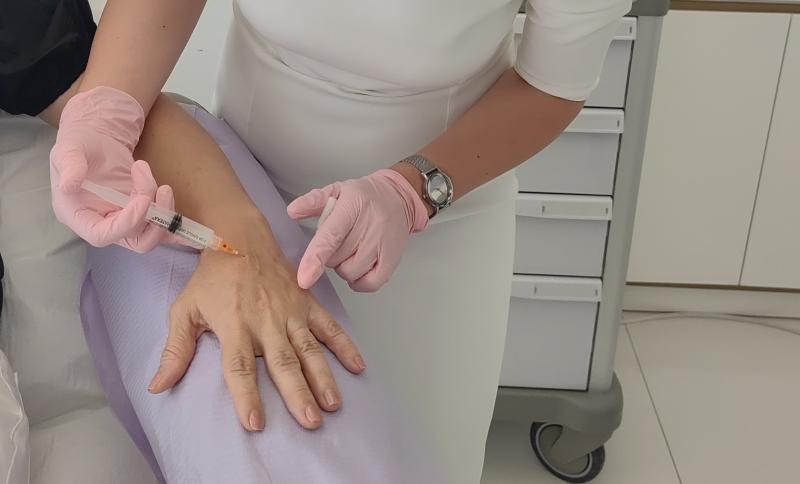 Injectare cu hidroxiapatită de calciu (Radiesse) pentru întinerire piele mâini