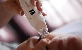 Mobilift frunte express